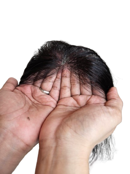 Receding Front Hairline Band 2 Receding Front Hairline Band